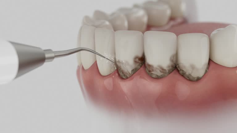 Trusted Tooth Extraction service in St. Charles, MI - Dentist Open Now